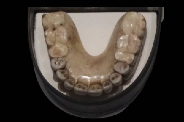 Waterloo Teeth